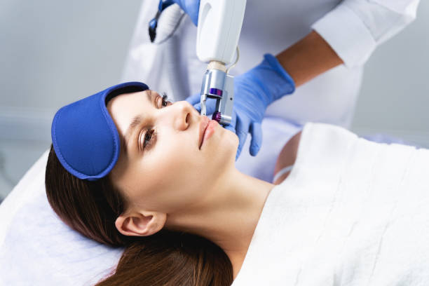 Ultimate Surgical Face Lift Guide